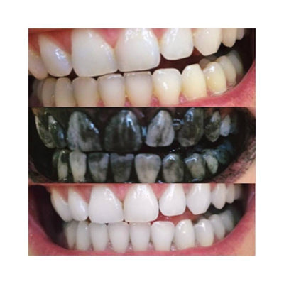 Teeth Whitening Charcoal Powder Charcoal Powder Timeless Matter 