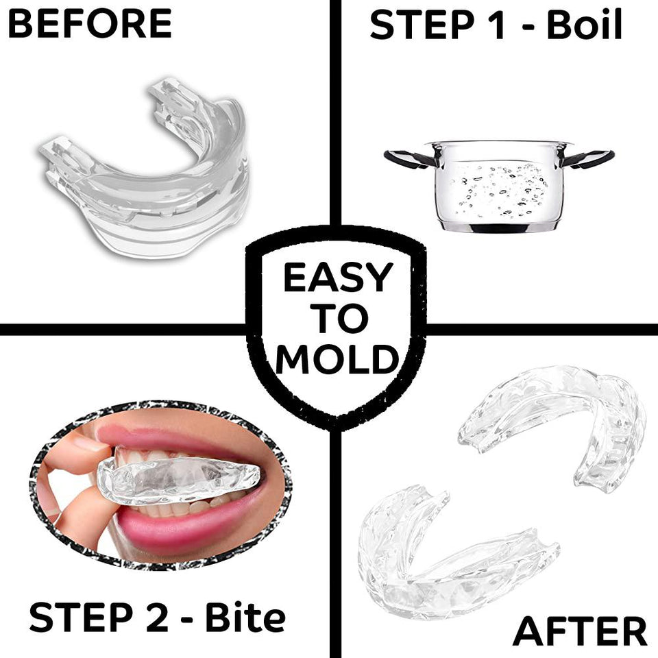 Adjustable Anti Snoring Mouthpiece / Mouthguard (Timeless Sleep V2) Mouthpiece V2 Timeless Matter 