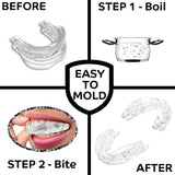 Adjustable Anti Snoring Mouthpiece / Mouthguard (Timeless Sleep V2) Mouthpiece V2 Timeless Matter 